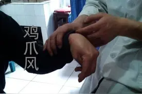 鸡爪风（疯）图片