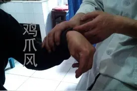 鸡爪风（疯）图片