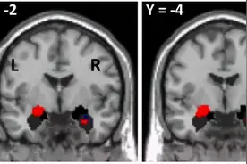 “指甲划黑板”的声音，为什么大多数人受不了？解读“恐音症”图片