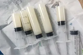 男子关节疼痛诊断为痛风，两年后膝盖抽出五针管积液后方知被误诊图片