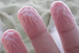 手指泡水时间长会变皱，是怎么回事？若不发皱说明身体更健康吗？图片