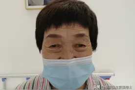 双眼皮、提眉、眼袋能不能一起做？65岁老太用真实经历告诉你图片