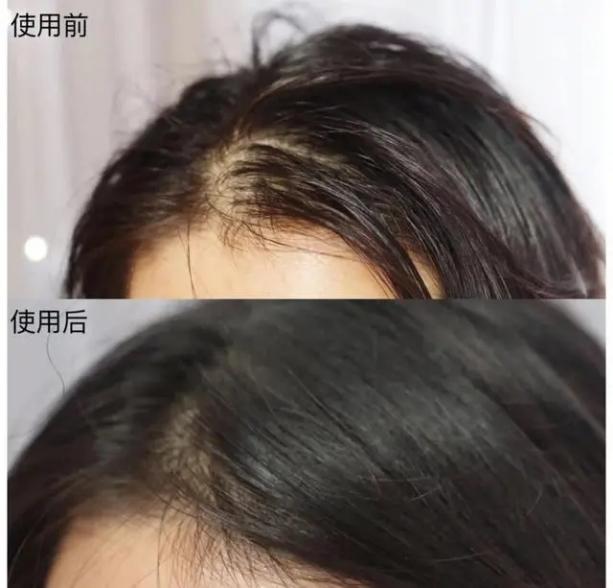 飘柔、海飞丝“无人问津”，国货第一洗发水出现，蓬松控油去分叉