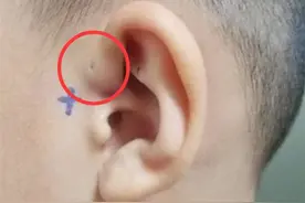 6个月宝宝耳边有个洞，奶奶好奇挤压，第二天却把孩子送进了医院图片