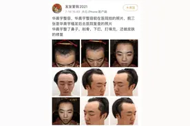 华晨宇方拒绝道歉，将追责到底，前经纪人回应图片