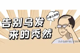脱发不用怕，先搞清楚原因再说……图片