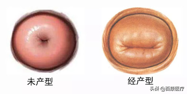 婚前做过人流手术，要不要跟医生坦白？