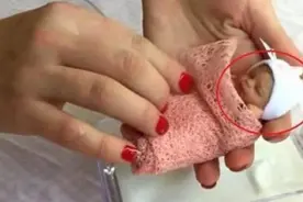 被誉为世界最小婴儿，出身仅有25厘米巴掌女孩，如今成了小美女图片