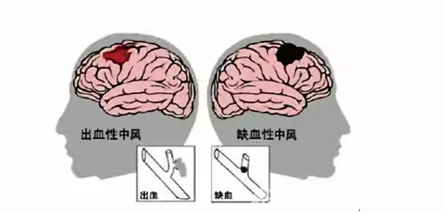 小分子肽对心脏的功效与作用 2026年最新小分子肽对心脏的功效与作用