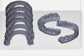 隐形矫正里运用的3D打印是什么神秘科技图片