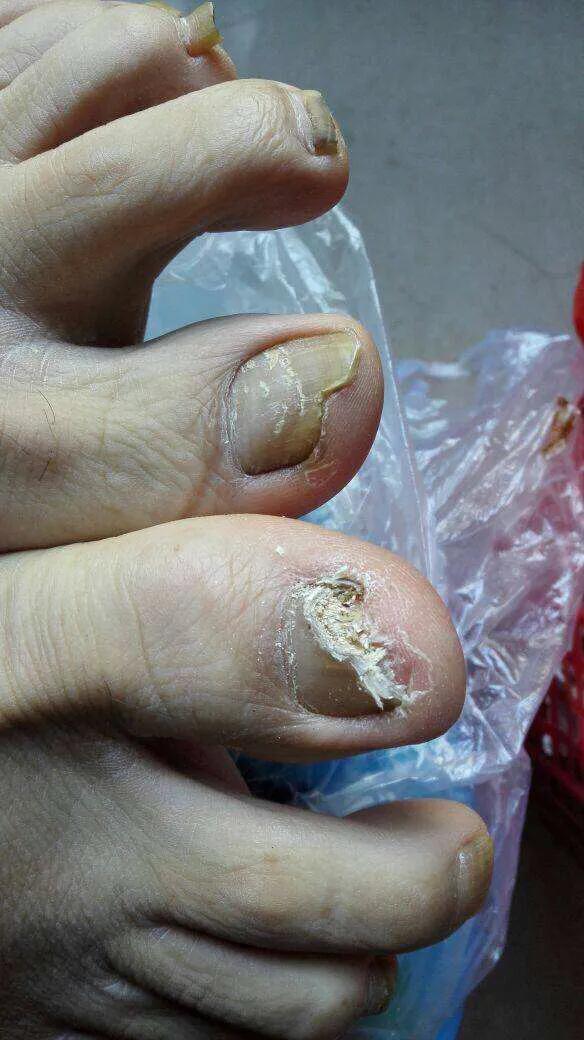 痒痒痒，常见的7种皮肤病用药大全！