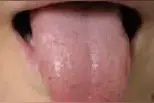 小庸爱中医～舌诊之舌色图片
