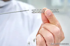 心脏支架后能活几年？医生实话实说：支撑生命的是这3个关键点图片