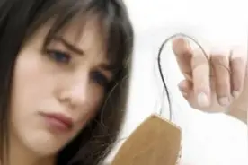 说起脱发秃头，女人比男人更慌图片