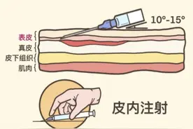 平常看病打针，可是你知道吗？这种打针方式疼痛明显图片