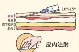 平常看病打针，可是你知道吗？这种打针方式疼痛明显图片