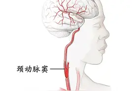 脖子上的这个穴，不懂千万不要摁！图片