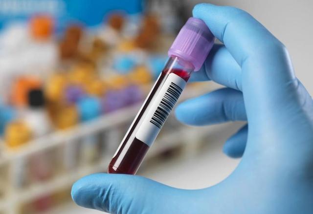 不稳定血红蛋白病和染色体有关，多数患者没有家族史，预后良好