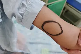 当心！9岁女童撸猫后 竟然得了“怪病”图片