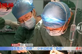 脸上小“疙瘩”没在意，最终切除半张脸？医生：多发生在中老年人图片