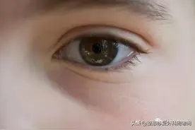 传说中的瘦脸针，打完真的会脸僵吗？看完我明白了图片