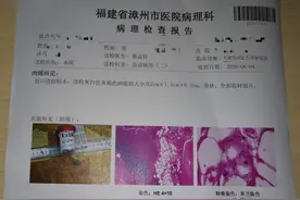 一定要重视！漳州一名高龄患者被鸡爪抓伤引发破伤风图片