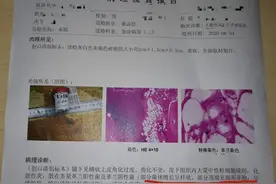 一定要重视！漳州一名高龄患者被鸡爪抓伤引发破伤风图片