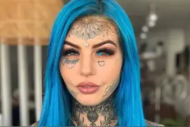 澳洲龙纹身女孩做丰臀手术，每天要用尿不湿，曾眼球染色失明三周图片