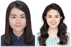 我的双眼皮恢复日志图片