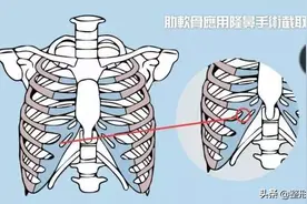 肋软骨隆鼻真的有那么好吗？我们来一起看看真相图片