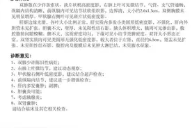 当地医院治好了她的急性胰腺炎却说不清病因，她又来省级医院就诊图片