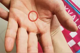 手掌上有这样的纹络，颈椎病已经在影响您的心脏图片