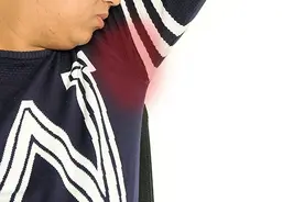 体味是怎么来的，为啥有人体味重？图片
