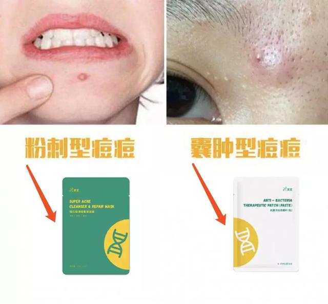 我花1000元买来10款热门医美面膜，告诉你们哪款最好用