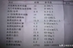 去医院做肝功检查，拿到化验报告单看不懂怎么办？医生:不用慌！图片
