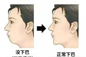 没下巴的人，可能真的不是因为胖图片