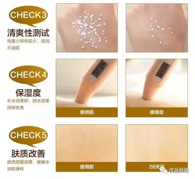 银屑病能用什么身体乳