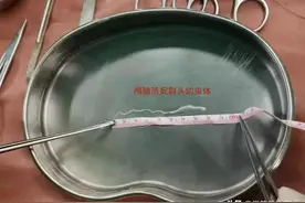 脑子居然长虫了？小心寄生虫裂头蚴图片