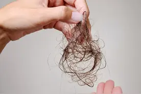 想不到吧，脱发竟然和缺蛋白质有关！图片