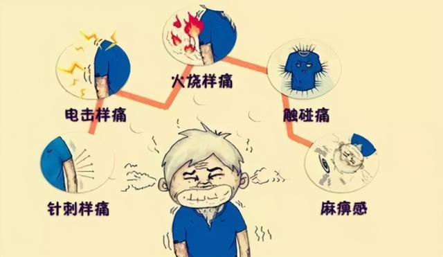 春季带状疱疹高发，专家：约五成患者遗留神经痛，简单4招可预防