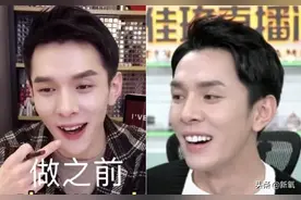 直播界的两大巨头李佳琦、薇娅都去do脸了？还是同一个地方…图片