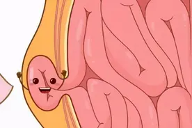 【科室之窗】勿以“疝”小而不为，老年疝气治疗要趁早图片