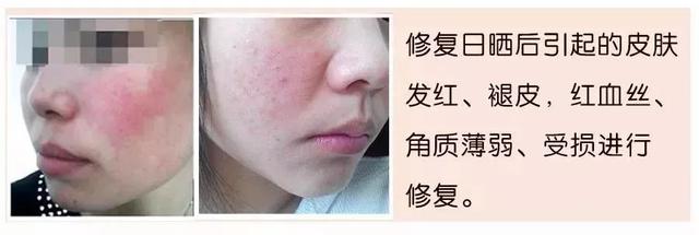 冻干粉是什么，有什么作用?如何正确使用？你想知道的都在这里了