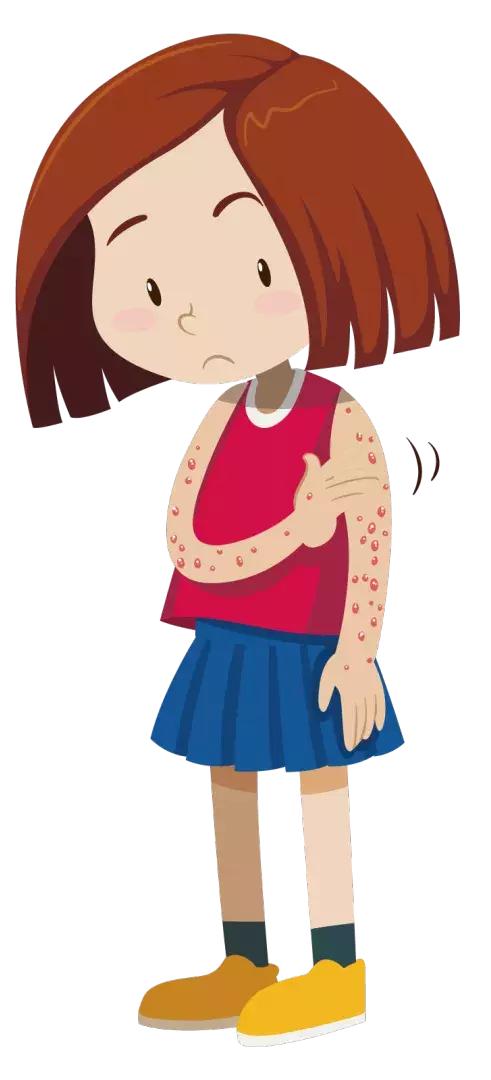 想要根治荨麻疹 就一定要了解这3种类型