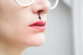 注意：一流鼻血就仰头，有可能错了！教你3个方法能快速止血图片