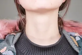 脖子上的“小肉疙瘩”是什么？或和5个因素有关，平时要留意图片