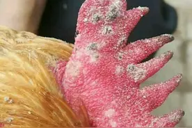 最近接诊鸡痘高发，你知道鸡痘的类型和怎么预防吗？图片