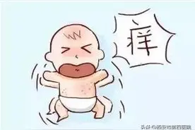 #我的健康十八式#  【宝宝使用含激素的软膏有什么注意事项？】图片