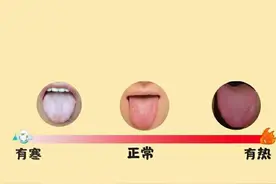 一张图，教你学会看孩子舌苔图片