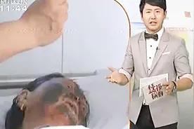 年过半百老太 晒了阳光 皮肤就黑如烤碳 原来是因为吃了一种菜视频封面